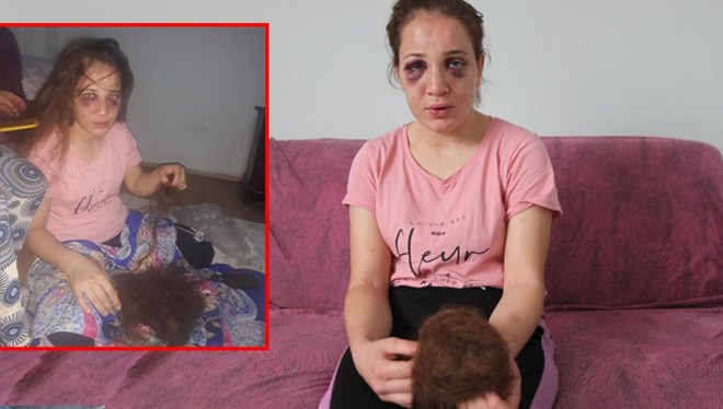 Bunu yapan serbest… KADININ “KORUMA İSTEĞİ” İSE….