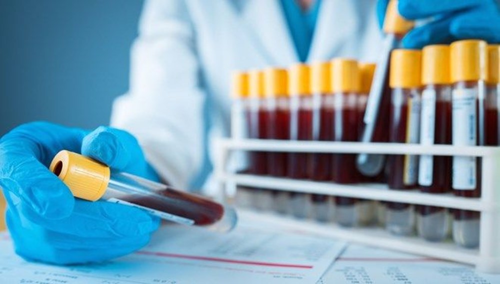 Müjde… KAN GRUBUNUZ SAYESİNDE KORONADAN YIRTABİLİRSİNİZ!